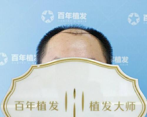 植发模拟器如何打造专属秀发？休闲新体验有哪些特点？